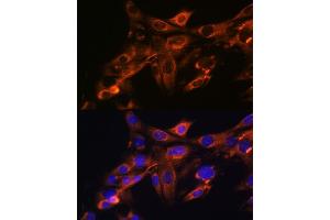 Immunofluorescence analysis of NIH-3T3 cells using Src Rabbit mAb (ABIN7269727) at dilution of 1:100 (40x lens).