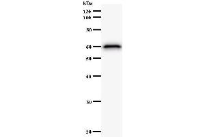 Western Blotting (WB) image for anti-Lysine (K)-Specific Demethylase 4A (KDM4A) antibody (ABIN932195) (KDM4A 抗体)