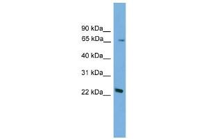 WB Suggested Anti-Foxn2 Antibody Titration:  0. (FOXN2 抗体  (N-Term))