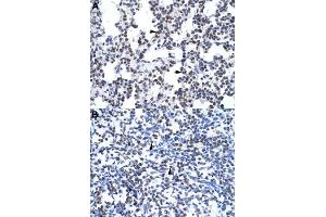 Immunohistochemical staining (Formalin-fixed paraffin-embedded sections) of human lung (A) and human spleen (B) with GCM1 polyclonal antibody  at 4-8 ug/mL working concentration. (GCM1 抗体  (N-Term))