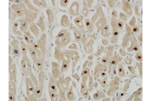 Immunoperoxidase of monoclonal antibody to TTN on formalin-fixed paraffin-embedded human heart. (Titin 抗体  (AA 1-110))