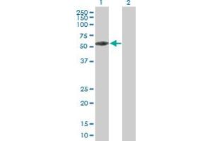 Western Blot analysis of KBTBD9 expression in transfected 293T cell line by KBTBD9 MaxPab polyclonal antibody. (KLHL29 抗体  (AA 1-503))