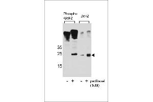 Western blot analysis of extracts from Jurkat cells,untreated or treated with paclitaxel,using phospho-Bcl2(Ser70)(left) or Bcl2 Antibody (right). (Bcl-2 抗体  (pSer70))