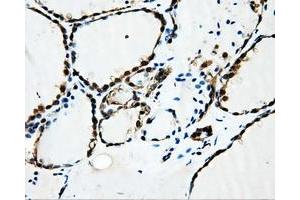 Image no. 3 for anti-Sorbitol Dehydrogenase (SORD) antibody (ABIN1501076) (SORD 抗体)
