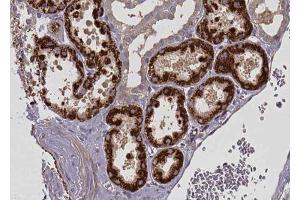 ABIN6272848 at 1/100 staining human kidney tissue sections by IHC-P. (CPT1A 抗体  (Internal Region))