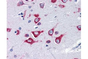 Anti-KIF5A antibody IHC of human brain, cortex. (KIF5A 抗体  (Internal Region))