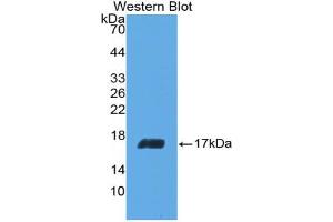 Western blot analysis of the recombinant protein. (IL-5 抗体  (AA 20-134))