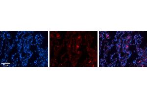 Rabbit Anti-FBXO21 Antibody     Formalin Fixed Paraffin Embedded Tissue: Human Lung Tissue  Observed Staining: Membrane and cytoplasmic in alveolar type I cells  Primary Antibody Concentration: 1:100  Other Working Concentrations: 1/600  Secondary Antibody: Donkey anti-Rabbit-Cy3  Secondary Antibody Concentration: 1:200  Magnification: 20X  Exposure Time: 0. (FBXO21 抗体  (N-Term))