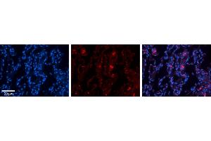 Rabbit Anti-FBXO21 Antibody     Formalin Fixed Paraffin Embedded Tissue: Human Lung Tissue  Observed Staining: Membrane and cytoplasmic in alveolar type I cells  Primary Antibody Concentration: 1:100  Other Working Concentrations: 1/600  Secondary Antibody: Donkey anti-Rabbit-Cy3  Secondary Antibody Concentration: 1:200  Magnification: 20X  Exposure Time: 0. (FBXO21 抗体  (N-Term))