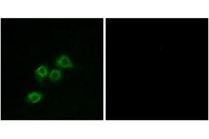 Immunofluorescence analysis of MCF7 cells, using GPR1 Antibody. (G Protein-Coupled Receptor 1 抗体  (AA 121-170))