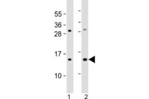 Western blot testing of 1) human HL-60 and 2) mouse Neuro-2a cell lysate with EIF1 antibody at 1:2000.