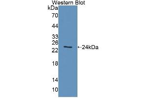 Western blot analysis of the recombinant protein. (ACADS 抗体  (AA 210-396))