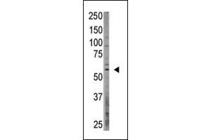 Western Blotting (WB) image for anti-CAMP Responsive Element Binding Protein 3-Like 1 (CREB3L1) (AA 490-519), (C-Term) antibody (ABIN358719) (CREB3L1 抗体  (C-Term))
