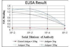 Red: Control Antigen (100 ng), Purple: Antigen (10 ng), Green: Antigen (50 ng), Blue: Antigen (100 ng), (MAP2K4 抗体)