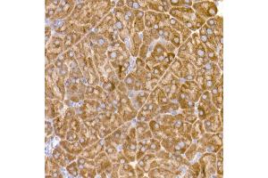 Immunohistochemistry of paraffin-embedded mouse pancreas using eIF1A Rabbit mAb (ABIN7267027) at dilution of 1:50 (40x lens).