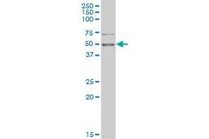 PHF1 monoclonal antibody (M02), clone 4D8 Western Blot analysis of PHF1 expression in K-562 . (PHF1 抗体  (AA 2-100))