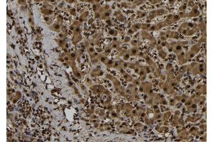ABIN6259972 and ABIN6276971 at 1/100 staining Human liver tissue by IHC-P.