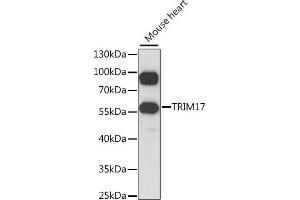 Western blot analysis of extracts of mouse heart, using TRIM17 antibody  at 1:1000 dilution. (TRIM17 / RNF16 抗体  (AA 1-300))