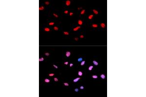 Immunofluorescence analysis of U2OS cells using Phospho-Rb-S811 antibody. (Retinoblastoma 1 抗体  (pSer811))