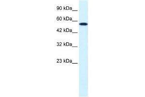 CHEK1 antibody used at 0. (CHEK1 抗体)