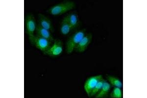 Immunofluorescent analysis of HepG2 cells using ABIN7144713 at dilution of 1:100 and Alexa Fluor 488-congugated AffiniPure Goat Anti-Rabbit IgG(H+L) (Asialoglycoprotein Receptor 2 抗体  (AA 63-286))