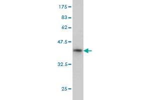 Western Blot detection against Immunogen (36. (NAT2 抗体  (AA 96-195))