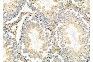 ABIN6263069 and ABIN6278932 at 1/100 staining Rat testis tissue by IHC-P. (MAGEC3 抗体  (N-Term))