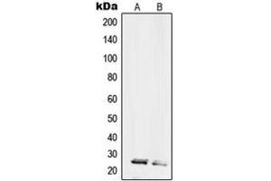 Western blot analysis of RPL10L expression in HL60 (A), HeLa (B) whole cell lysates. (RPL10L 抗体  (C-Term))