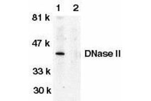 Western blot analysis of DNase II in human spleen tissue lysate in the absence (lane 1) or presence (lane 2) of blocking peptide with DNase II antibody at 1μg/ml. (DNASE2 抗体)