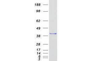Validation with Western Blot