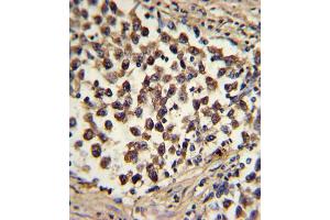 Immunohistochemistry (IHC) image for anti-SNAI antibody (ABIN2912021) (SNAI 抗体)
