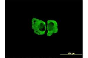 Immunofluorescence of monoclonal antibody to MSRA on HeLa cell. (MSRA 抗体  (AA 1-100))