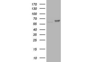 Image no. 1 for anti-Ribophorin II (RPN2) antibody (ABIN1500757) (Ribophorin II 抗体)
