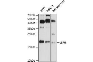 Western blot analysis of extracts of various cell lines, using LLPH antibody (ABIN7268289) at 1:1000 dilution. (LLPH 抗体  (AA 1-129))