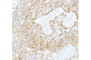 Immunohistochemistry (IHC) image for anti-Tubulin, beta 3 (TUBB3) (AA 400-450) antibody (ABIN7453957) (Recombinant TUBB3 抗体  (AA 400-450))