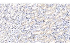 Detection of IL18 in Rabbit Kidney Tissue using Polyclonal Antibody to Interleukin 18 (IL18) (IL-18 抗体  (AA 32-192))