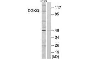 Western blot analysis of extracts from HT-29 cells, using DGKQ Antibody. (DGKQ 抗体  (AA 691-740))