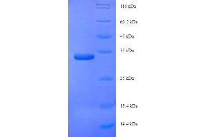 SDS-PAGE (SDS) image for Adhesion Regulating Molecule 1 (Adrm1) (AA 2-156) protein (His-SUMO Tag) (ABIN5711183)