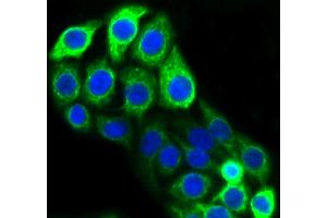 CRC cells were fixed in paraformaldehyde, permeabilized with 0. (KRT20 抗体)