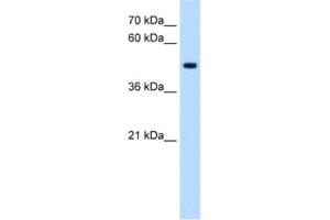 Western Blotting (WB) image for anti-serine/threonine/tyrosine Kinase 1 (STYK1) antibody (ABIN2463064) (STYK1 抗体)