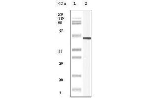 Western blot analysis using Vimentin mouse mAb against truncated Vimentin recombinant protein. (Vimentin 抗体)