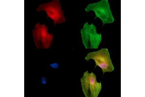 ABIN7096400 and ABIN7100464 staining  cells by IF/ICC. (PRAM1 抗体)