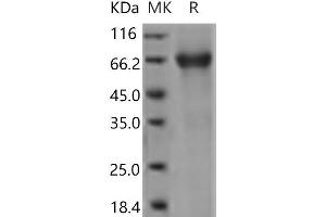 Western Blotting (WB) image for Interleukin 7 Receptor (IL7R) (Active) protein (Fc Tag) (ABIN7321220)