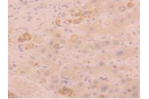 IHC-P analysis of Human Liver Tissue, with DAB staining. (FGL1 抗体  (AA 23-312))