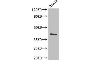 Western Blot Positive WB detected in: Mouse brain tissue All lanes: CD34 antibody at 3 μg/mL Secondary Goat polyclonal to rabbit IgG at 1/50000 dilution Predicted band size: 41, 36 kDa Observed band size: 41 kDa (CD34 抗体  (AA 124-375))