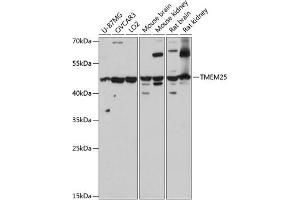 Western blot analysis of extracts of various cell lines, using TMEM25 antibody (ABIN7270963) at 1:3000 dilution. (TMEM25 抗体  (AA 223-322))