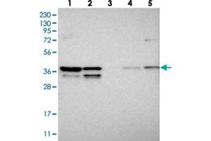 Western blot analysis of Lane 1: RT-4, Lane 2: U-251 MG, Lane 3: Human Plasma, Lane 4: Liver, Lane 5: Tonsil with SNRNP40 polyclonal antibody  at 1:250-1:500 dilution. (SNRNP40 抗体)