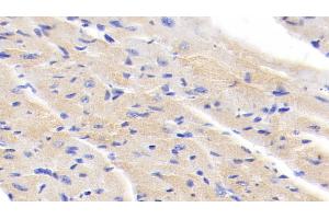 Detection of IkBb in Mouse Cardiac Muscle Tissue using Polyclonal Antibody to Inhibitory Subunit Of NF Kappa B Beta (IkBb) (Inhibitory Subunit of NF kappa B beta (AA 117-345) 抗体)