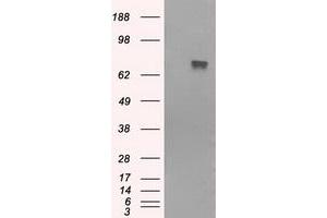 HEK293T cells were transfected with the pCMV6-ENTRY control (Left lane) or pCMV6-ENTRY BTK (Right lane) cDNA for 48 hrs and lysed. (BTK 抗体)