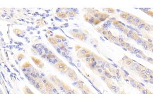 Detection of BFP in Mouse Stomach Tissue using Polyclonal Antibody to Brain Finger Protein (BFP) (RNF112 抗体  (AA 403-647))